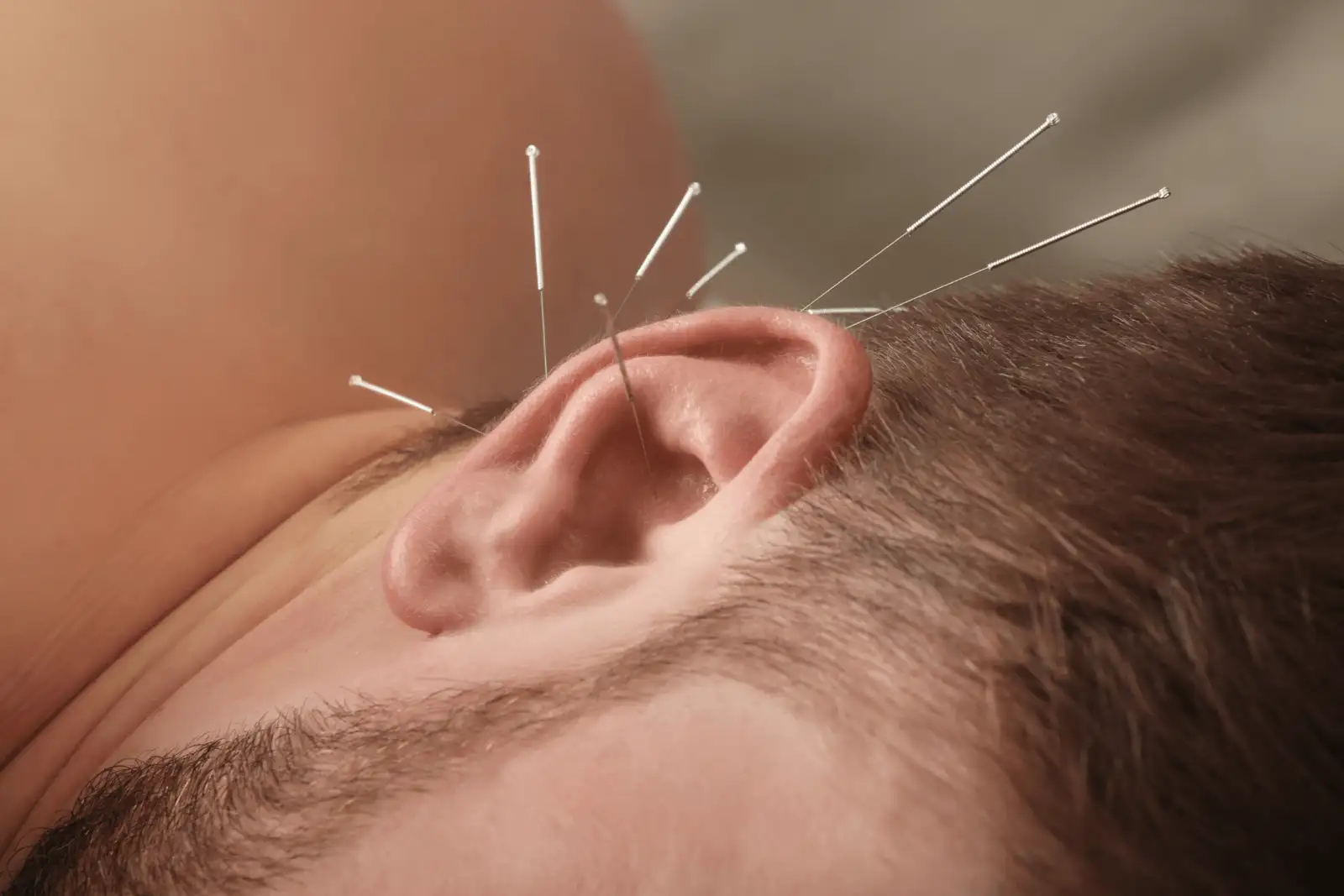 Traditional Chinese Medicine & Acupuncture
